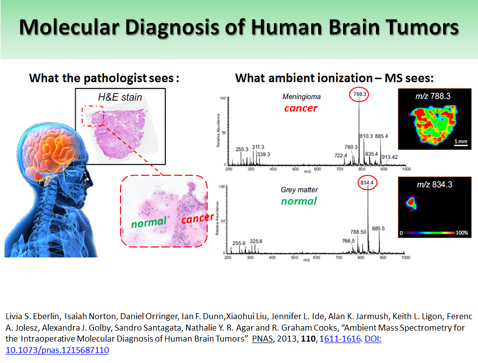 Molecular Diagnosis of Human Brain Tumors