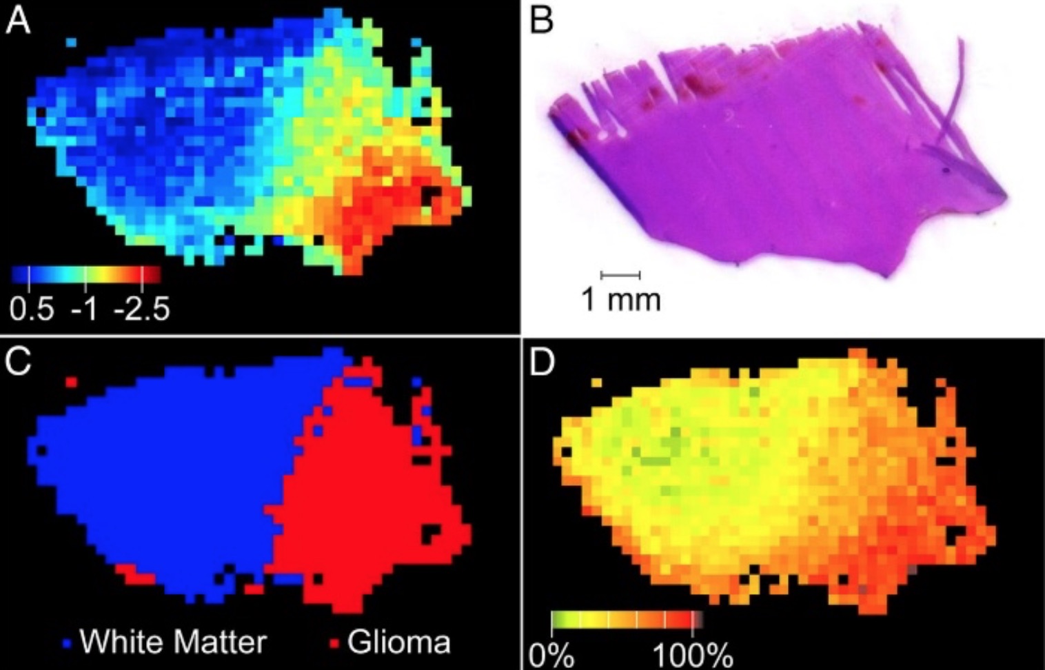 Brain Cancer Diagnostics