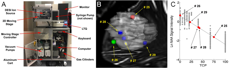 Brain Cancer Diagnostics